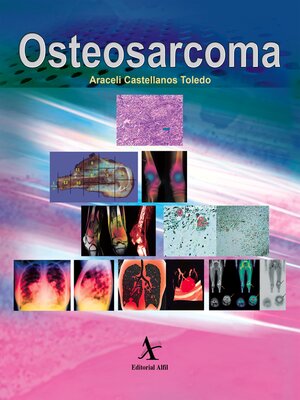 cover image of Osteosarcoma